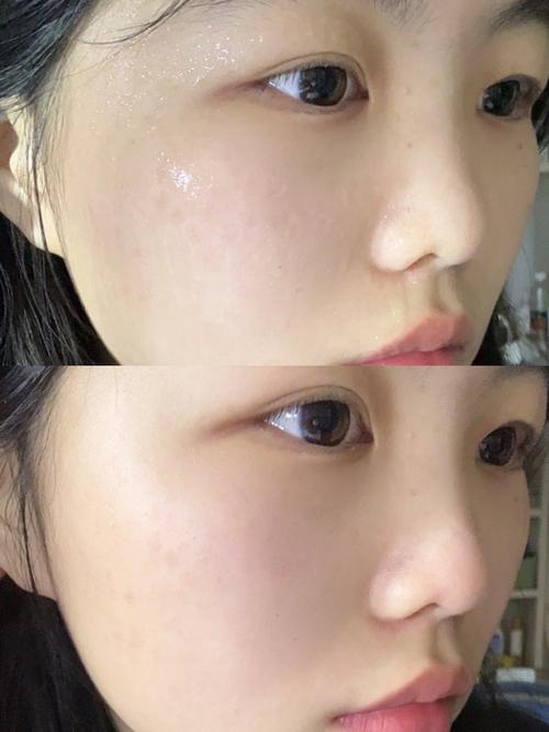 专利科技！丝芙菲精华液专利成分抗老美白双效精华