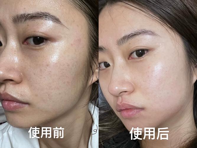黄垮脸救星！雪肌+美白抗皱精华液淡纹提亮一步到位