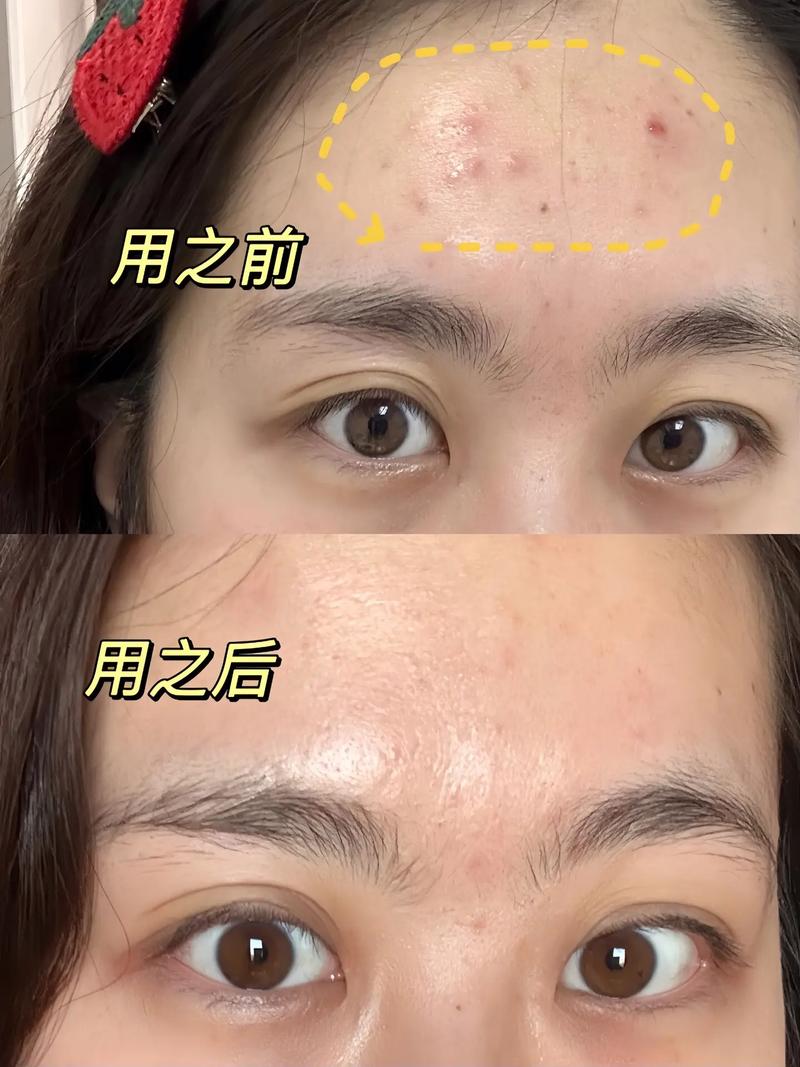丝芙菲精华液敏感肌可用｜温和抗皱淡纹提亮修护精华液