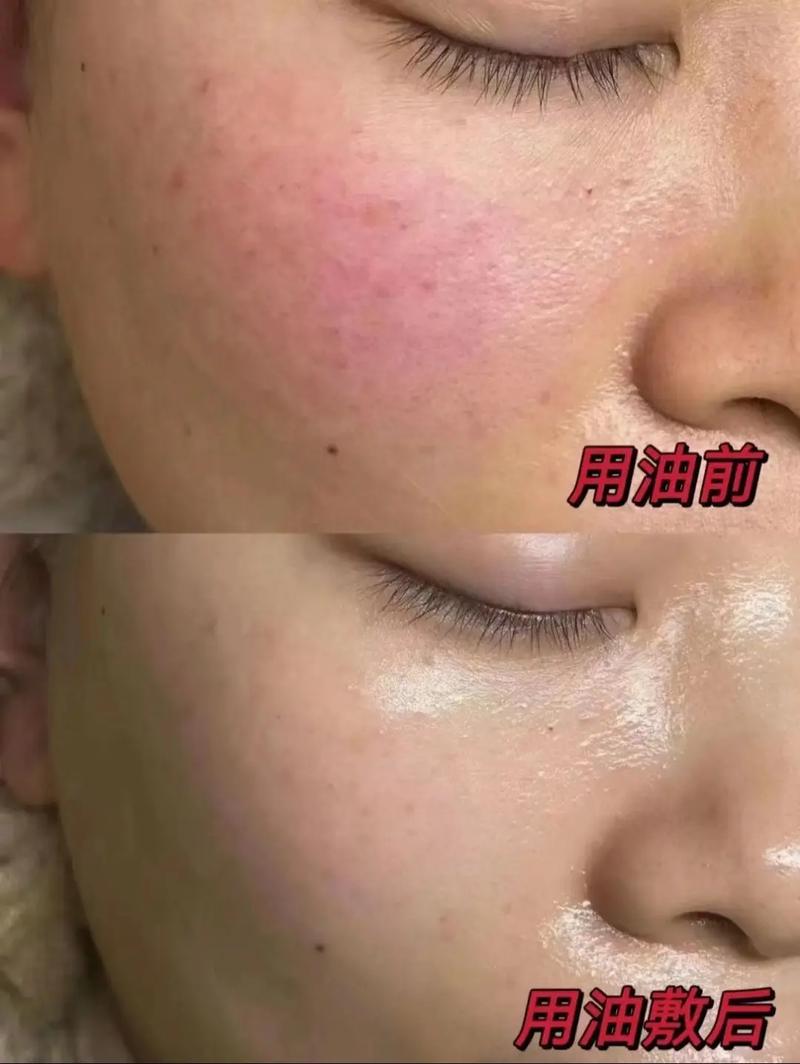 丝芙菲精华液孕妇可用｜温和抗皱淡纹提亮保湿精华液
