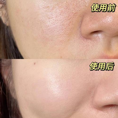 丝芙菲精华液国妆备案｜正品抗皱美白淡纹紧致精华液