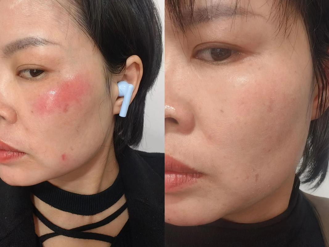 丝芙菲保湿精华霜｜长效保湿 8 小时，秋冬不干燥不卡粉