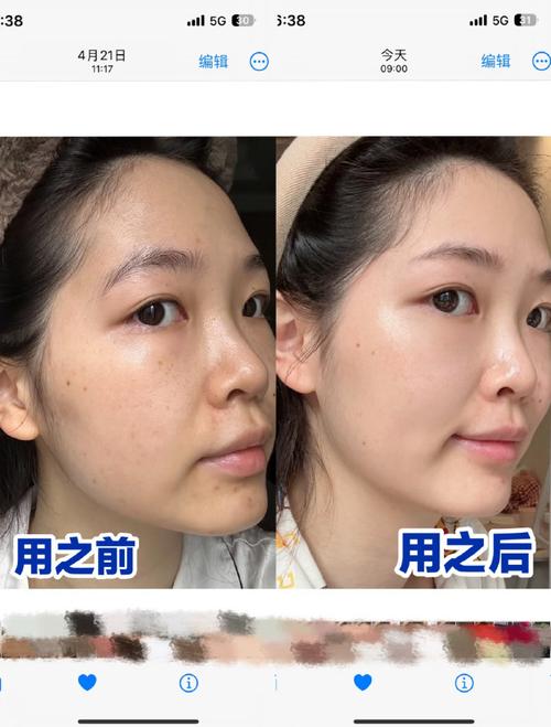 丝芙菲滋润抗皱霜｜温和不刺激，敏感肌干皮滋润抗皱
