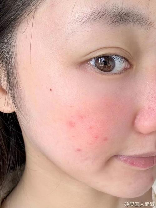 丝芙菲熟龄肌面霜｜玻色因 + 胜肽，强韧胶原改善松弛