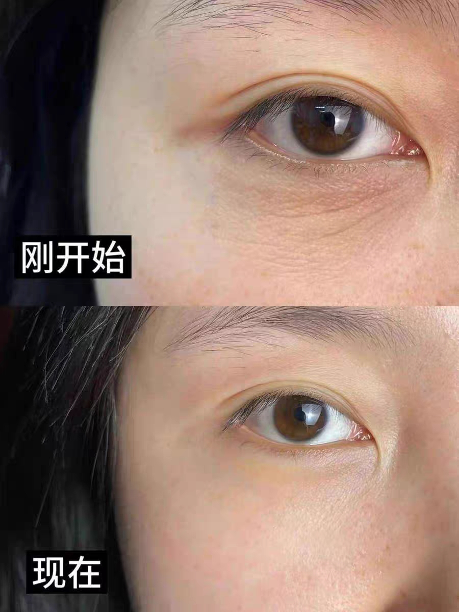 垮脸回春神器！丝芙菲塑颜抗皱紧致换肤套盒淡纹紧轮廓真的猛