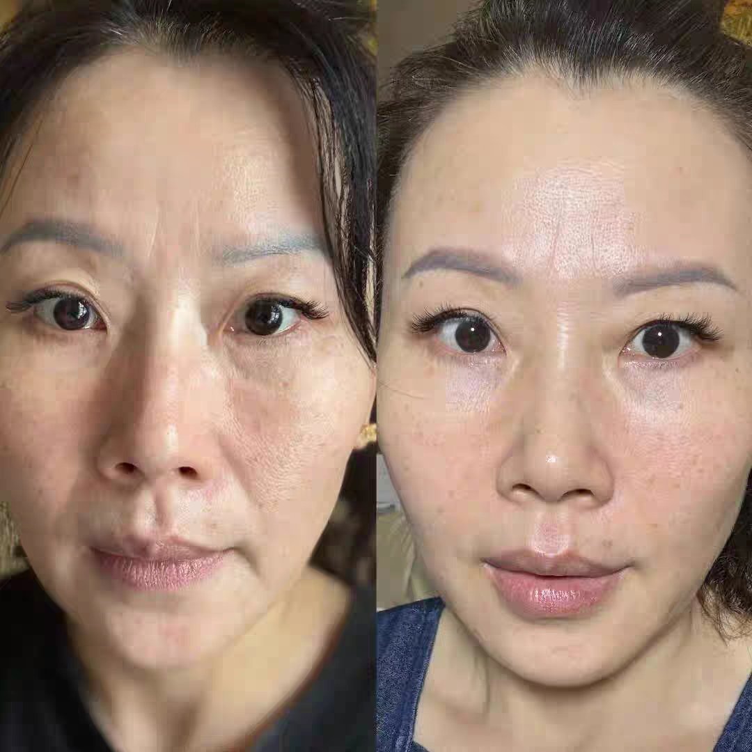 垮脸救星实锤！丝芙菲抗皱紧致套盒帮你把松垮轮廓直接拉回